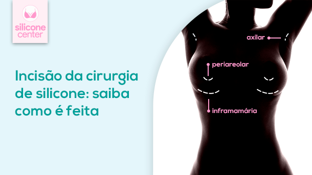 Incisão da cirurgia de silicone: saiba como é feita