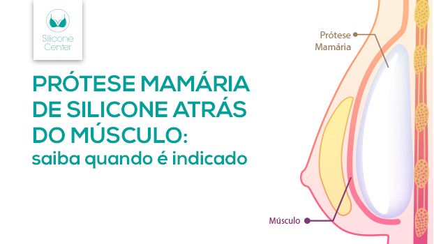 Prótese mamária de silicone atrás do músculo: saiba quando é indicada