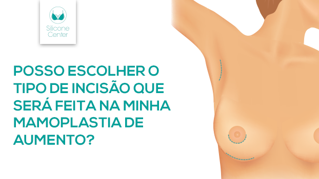 Incisão mamoplastia de aumento: posso escolher o tipo?
