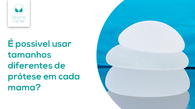 Tamanhos de prótese de silicone diferentes para cada mama: é possível corrigir assimetria?