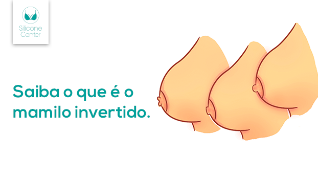 O que é mamilo invertido? Devo me preocupar? Existe correção?