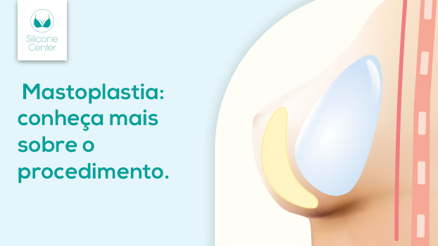 Você sabe o que é mastoplastia? Descubra todos os procedimentos que esta terminologia engloba