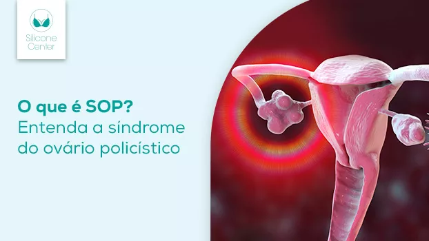O Que É SOP? Entenda a Síndrome do Ovário Policístico