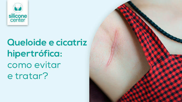 Queloide e cicatriz hipertrófica: como evitar e tratar?