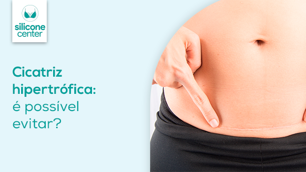 Cicatriz hipertrófica: é possível evitar?