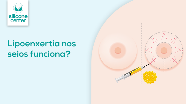 Lipoenxertia nos seios funciona?