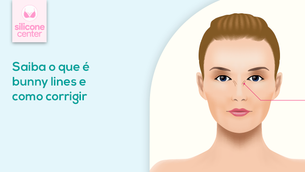 Você tem bunny lines? Descubra o que são e como corrigir