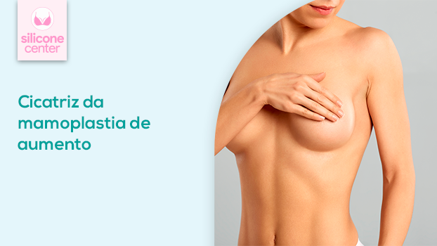 Mamoplastia cicatriz: tudo que você precisa saber