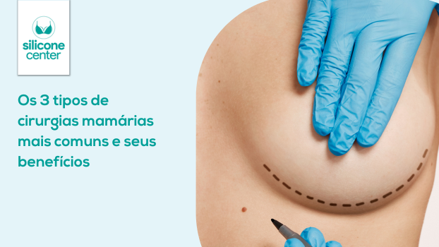 Os 3 tipos de cirurgias mamárias mais comuns e seus benefícios