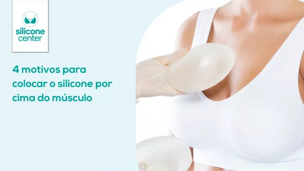 4 motivos para colocar o silicone por cima do músculo