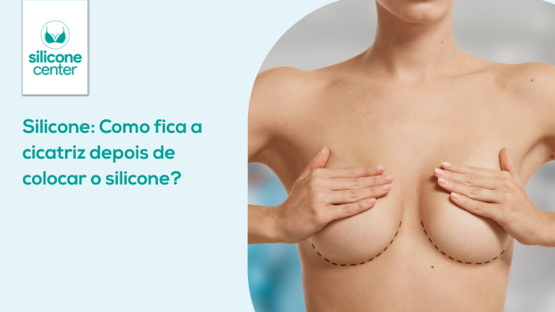 Silicone: Como fica a cicatriz depois de colocar a prótese?