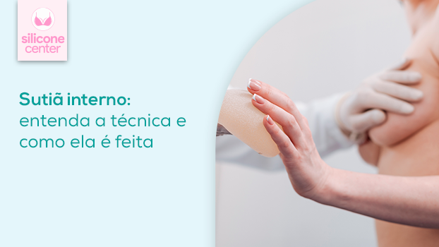 Entenda a técnica do sutiã interno em implantes de silicone
